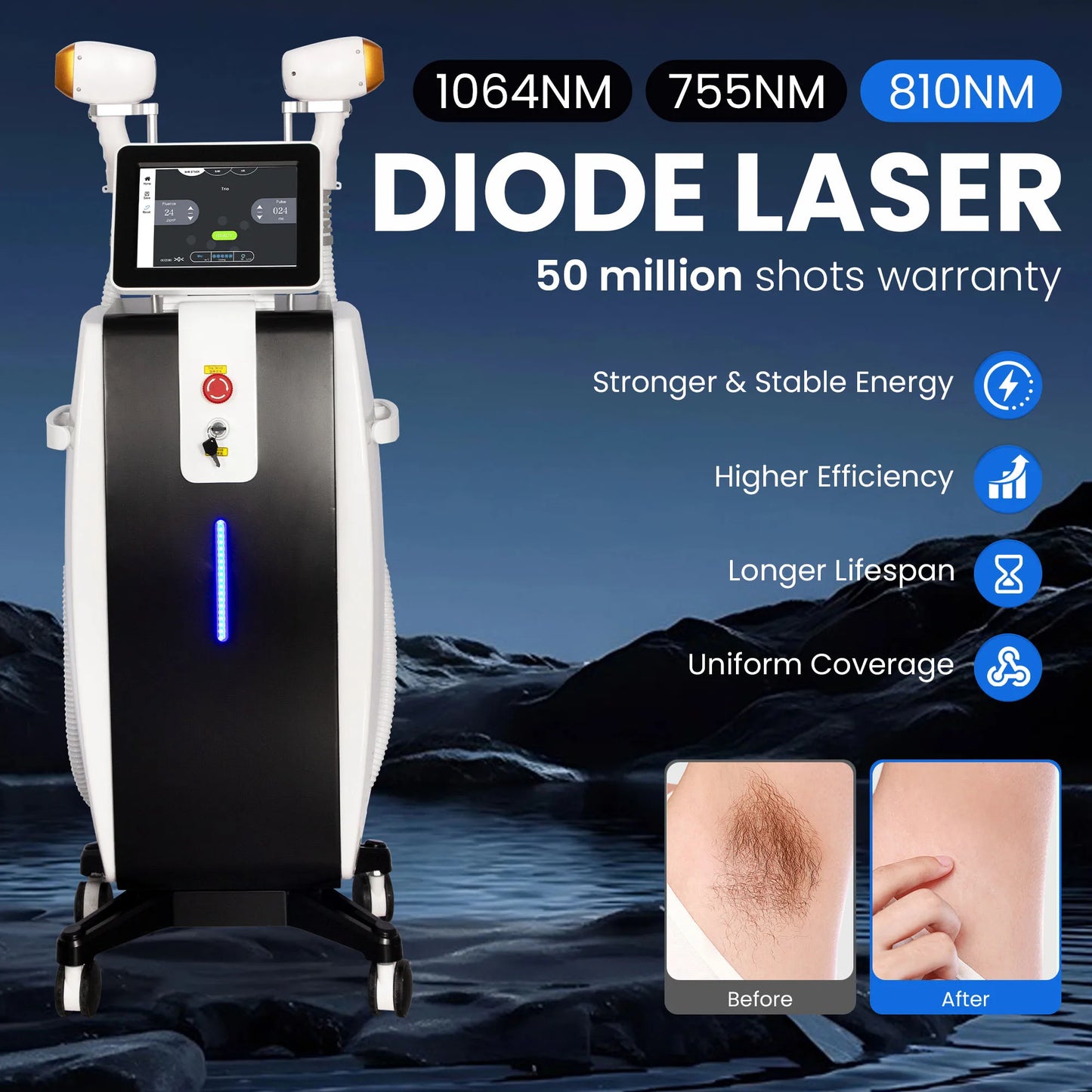 MYOSLIM 808nm Diode Hair Removal Machine For Full Body